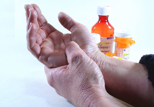 metodi di trattamento dell'artrite e dell'artrosi
