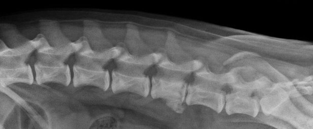 Manifestazioni di osteocondrosi della colonna vertebrale toracica su una radiografia