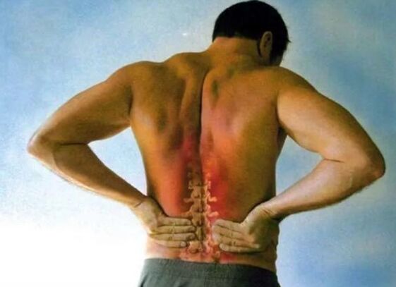 Dolore per osteocondosi lombare